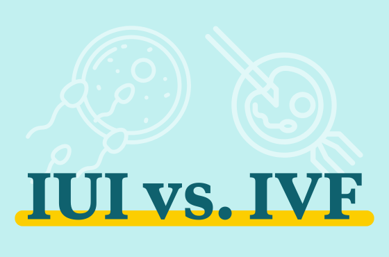 IUI vs IVF: Which fertility treatment is right for you? 